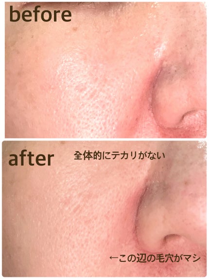 A1カーミング アンプル/VT/美容液を使ったクチコミ(5枚目)