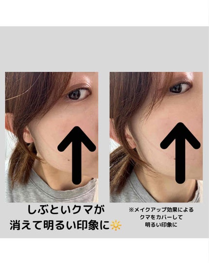 ディセンシア ハイカバーフィット コンシーラー/DECENCIA/リキッドコンシーラーを使ったクチコミ(5枚目)