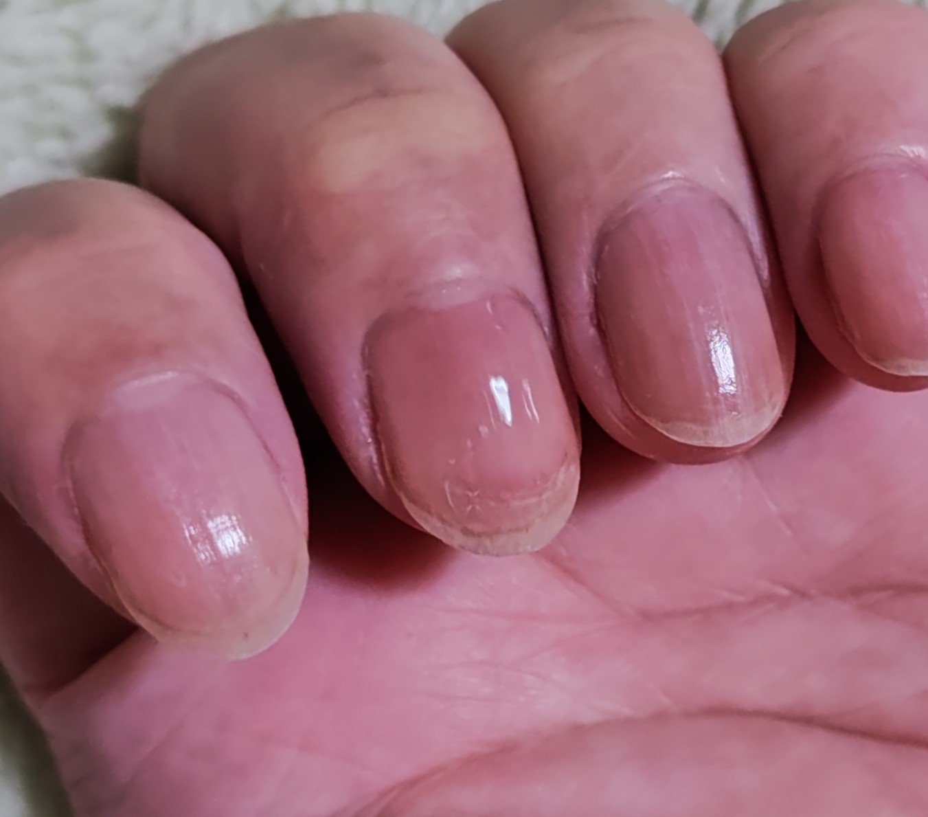 スプリットリペアN/ネイルネイル/ネイルオイル・トリートメントを使ったクチコミ（1枚目）