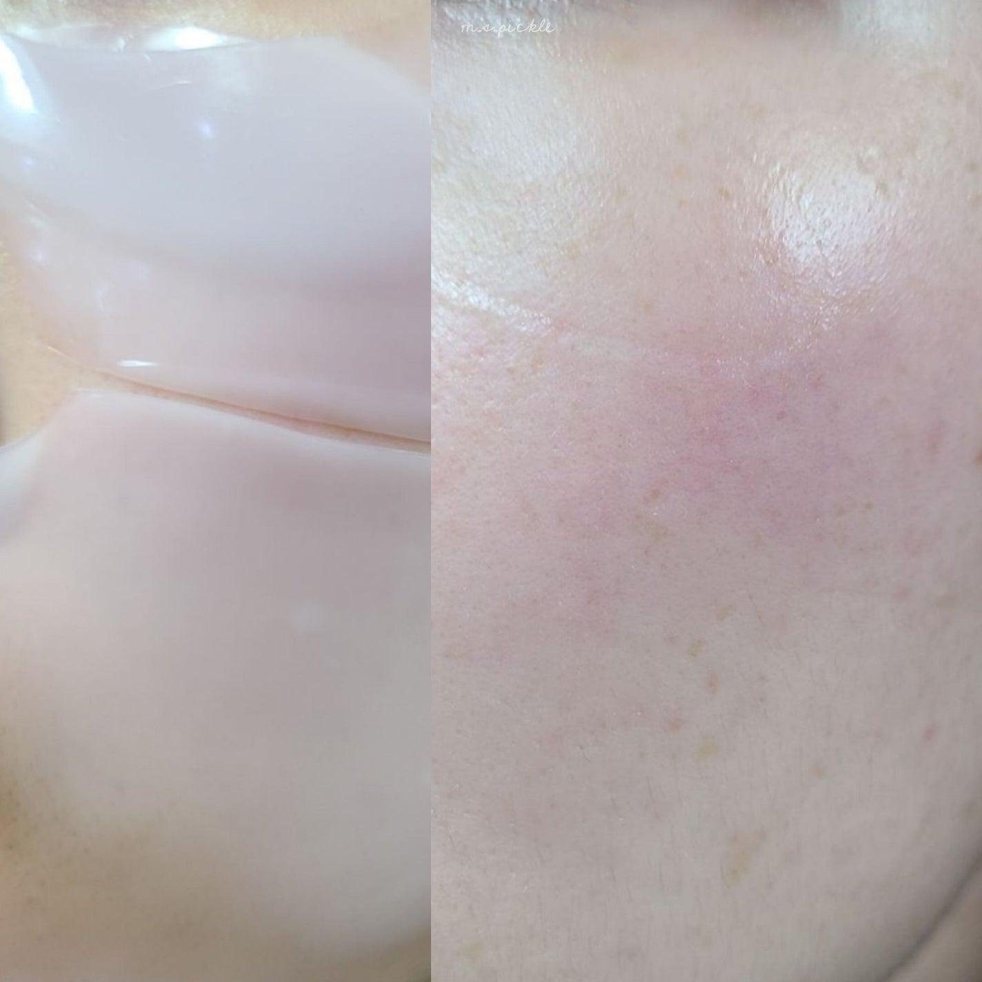 コラーゲンバウンスアップハイパーアクティブゲルマスク/SNP/シートマスク・パックを使ったクチコミ(4枚目)