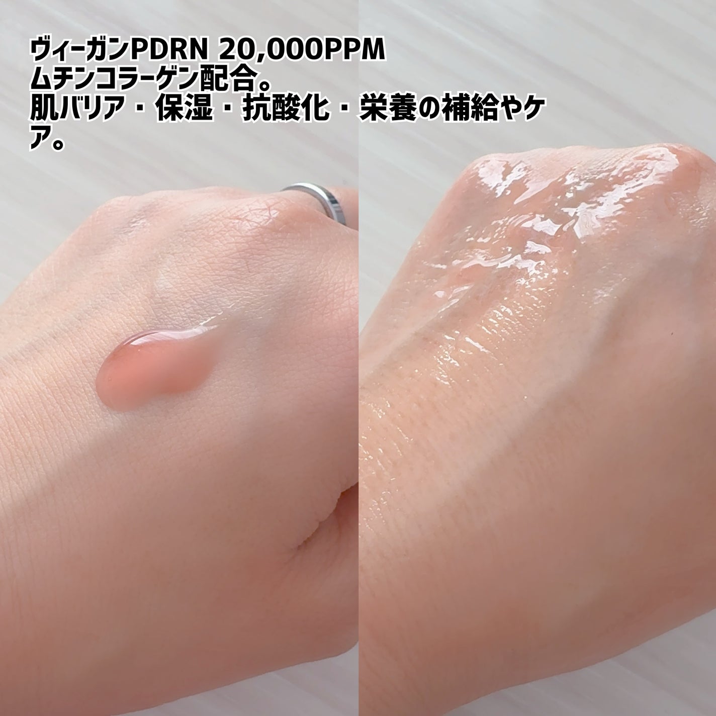 Dr.ROSA IV アンプル3種セット/Dr.ROSA/スキンケアキットを使ったクチコミ(3枚目)