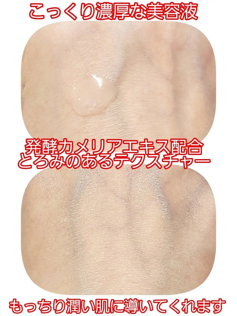 アルティミューン™ パワライジング セラム/SHISEIDO/美容液を使ったクチコミ（2枚目）