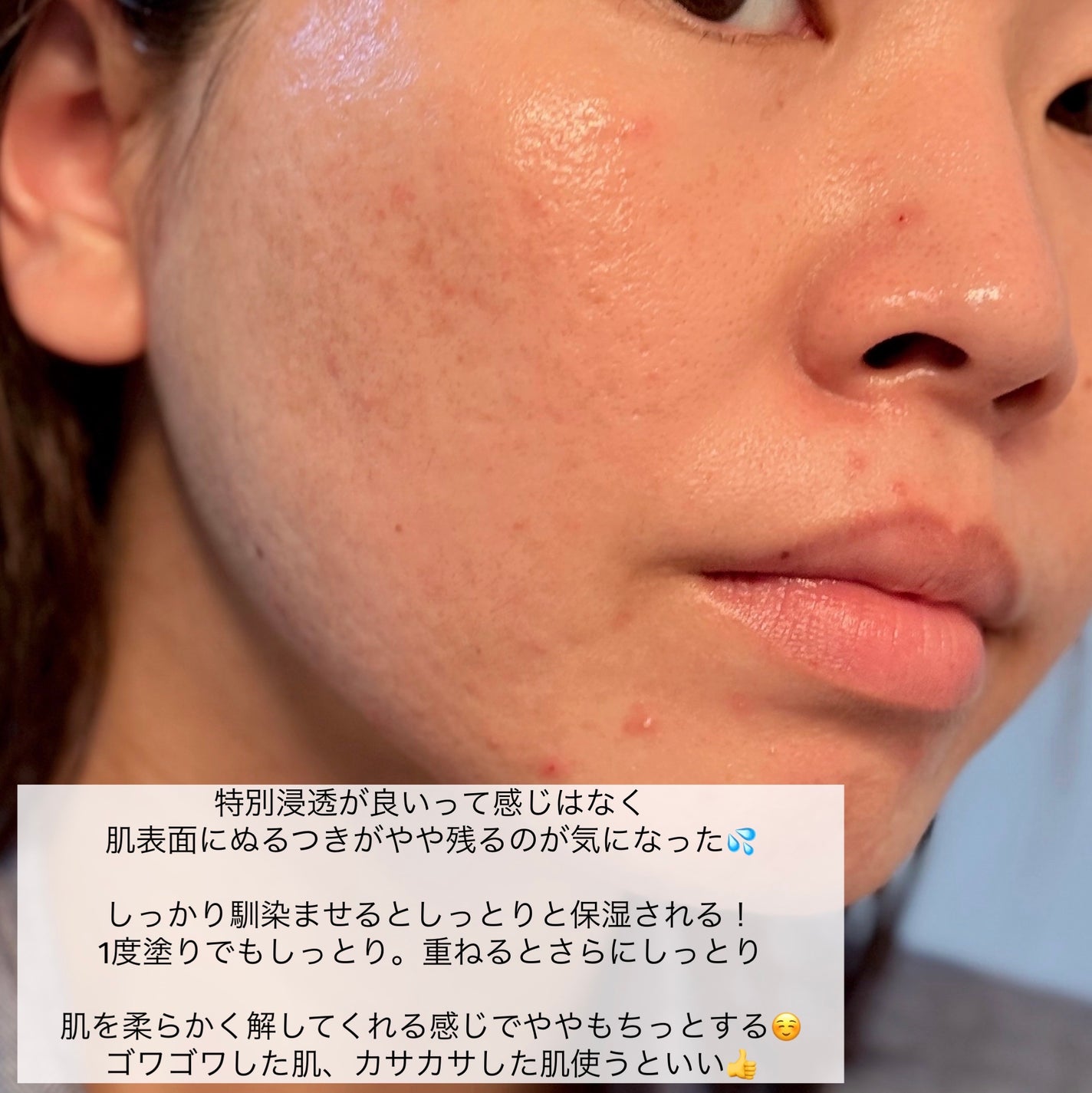 モイストケア ローション MB/d プログラム/化粧水を使ったクチコミ(4枚目)