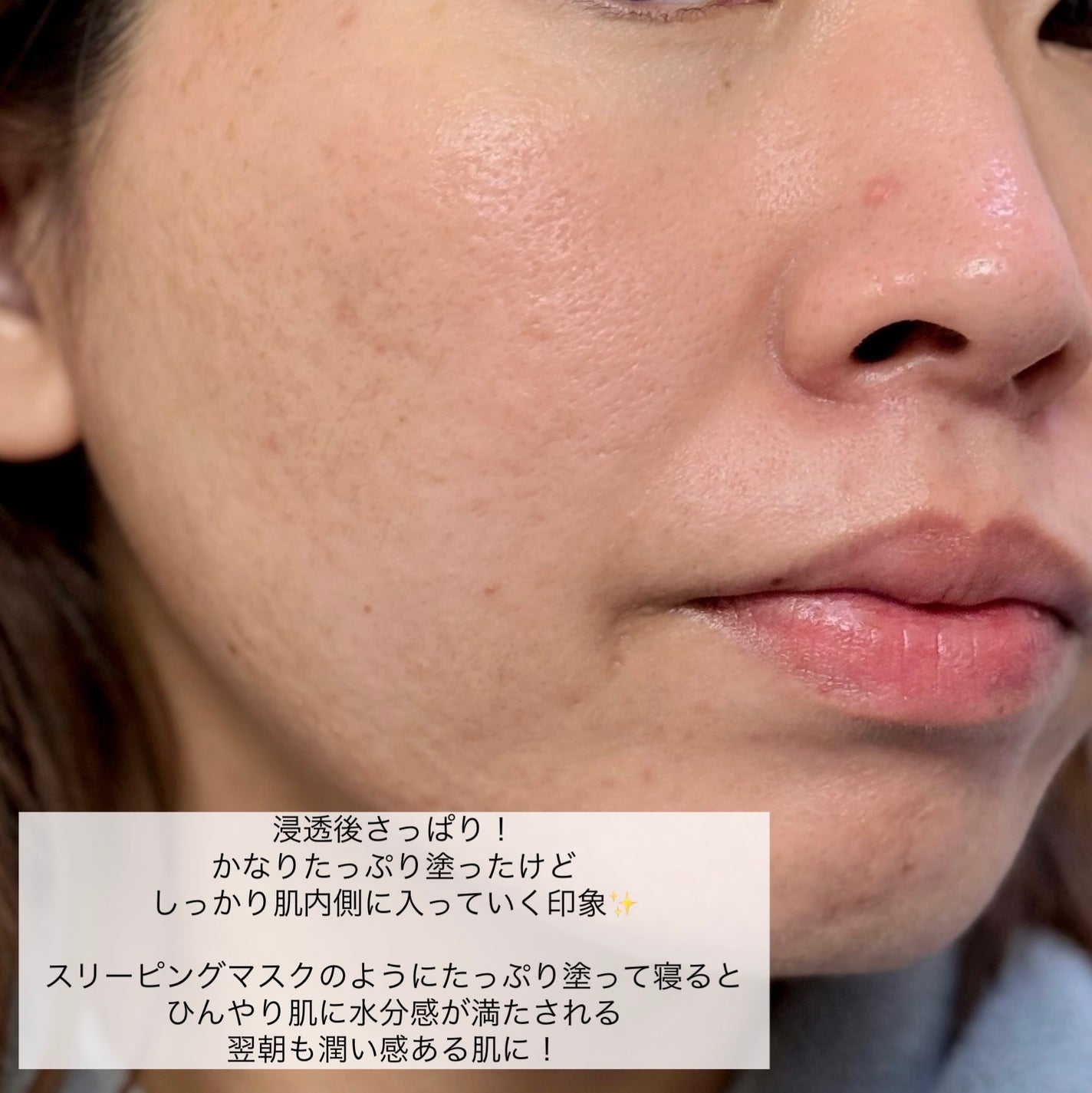 ワンダー BRHA エッセンス/haruharu wonder/美容液を使ったクチコミ(4枚目)