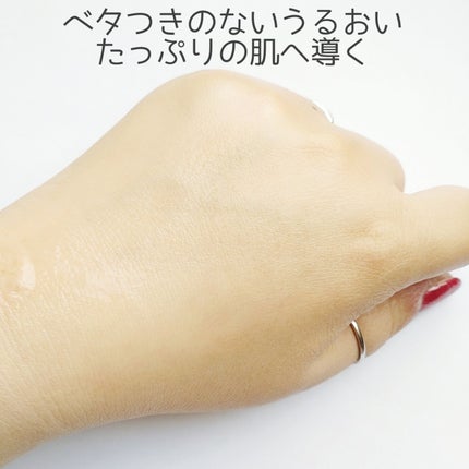 TXナイアシンエッセンストナー/SKIN&LAB/化粧水を使ったクチコミ(5枚目)