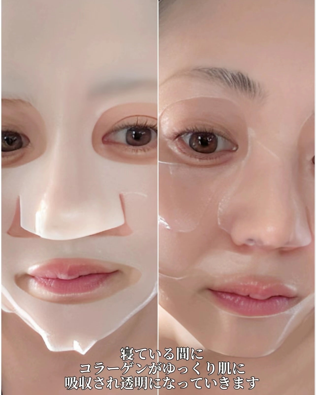 ✽ 佳 ✽スキンケア㋔㋟㋗ on LIPS 「𓂃𓈒𓏸衝撃🥚たまご肌韓国美女のつるつるなたまご肌の秘密💗現在ま..」(4枚目)