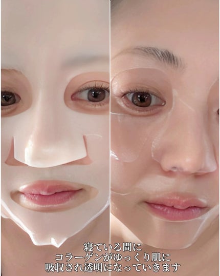 ✽ 佳 ✽スキンケア㋔㋟㋗ on LIPS 「𓂃𓈒𓏸衝撃🥚たまご肌韓国美女のつるつるなたまご肌の秘密💗現在ま..」(4枚目)