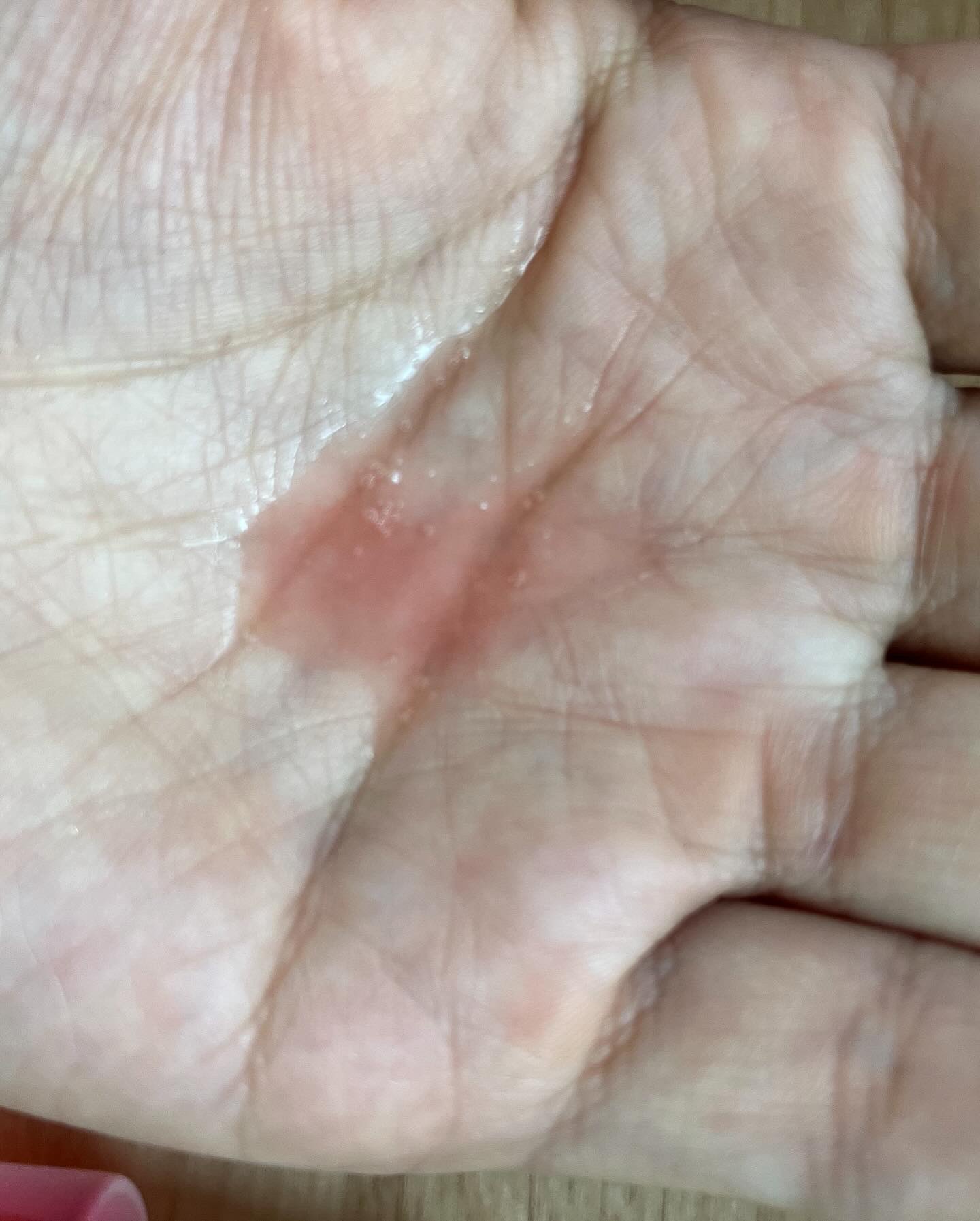 2チャージ/POWINK/美容液を使ったクチコミ（3枚目）