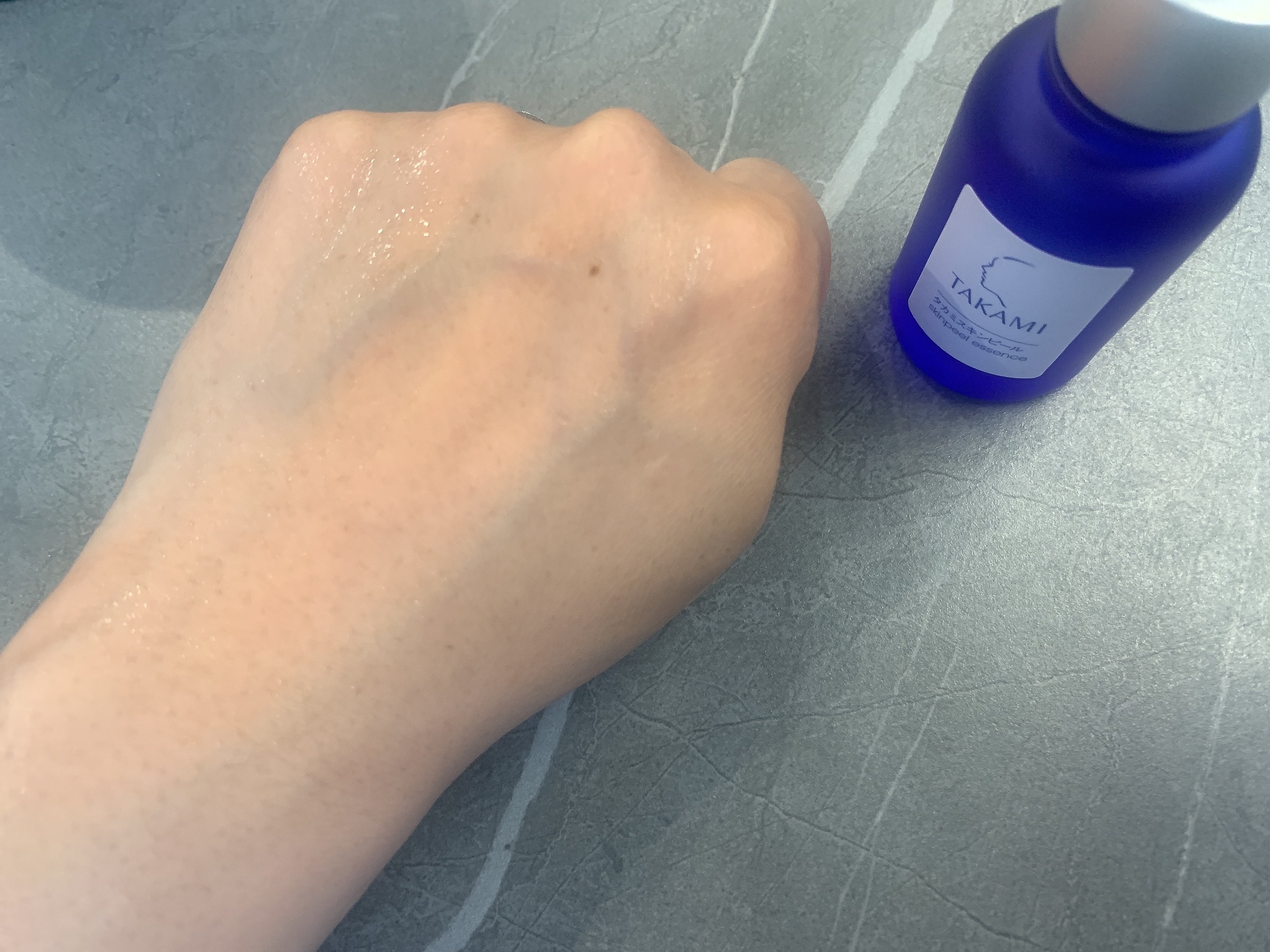 タカミスキンピール/タカミ/ブースター・導入液を使ったクチコミ（3枚目）