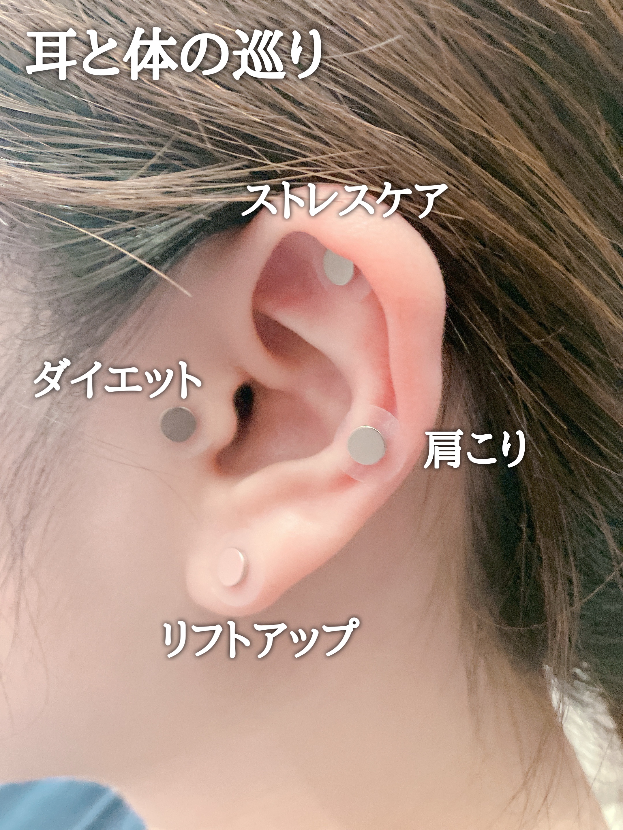 イヤーセラピー/RETURNITY/その他を使ったクチコミ（3枚目）