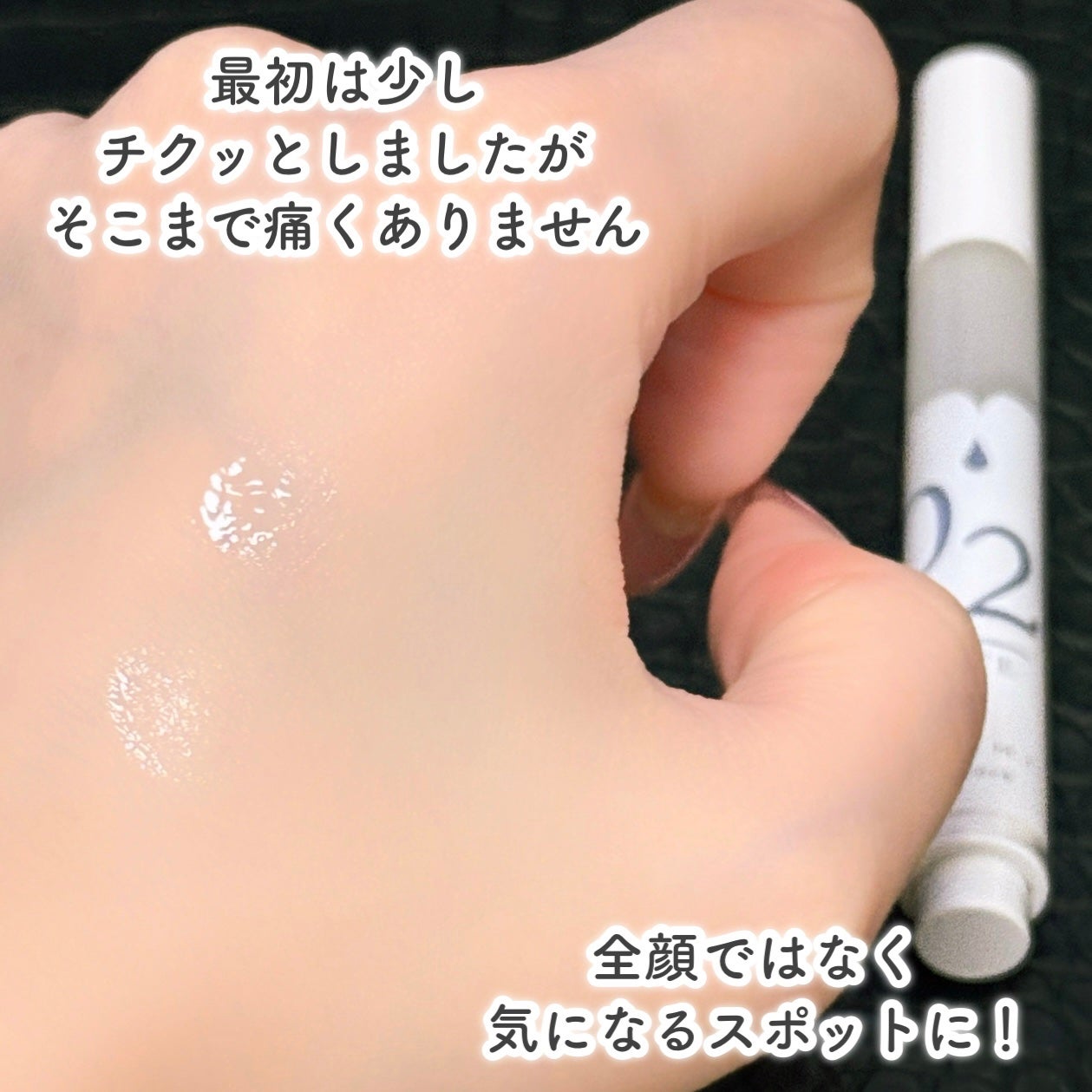 スポットノック WHITE/KIWAMI/美容液を使ったクチコミ(5枚目)