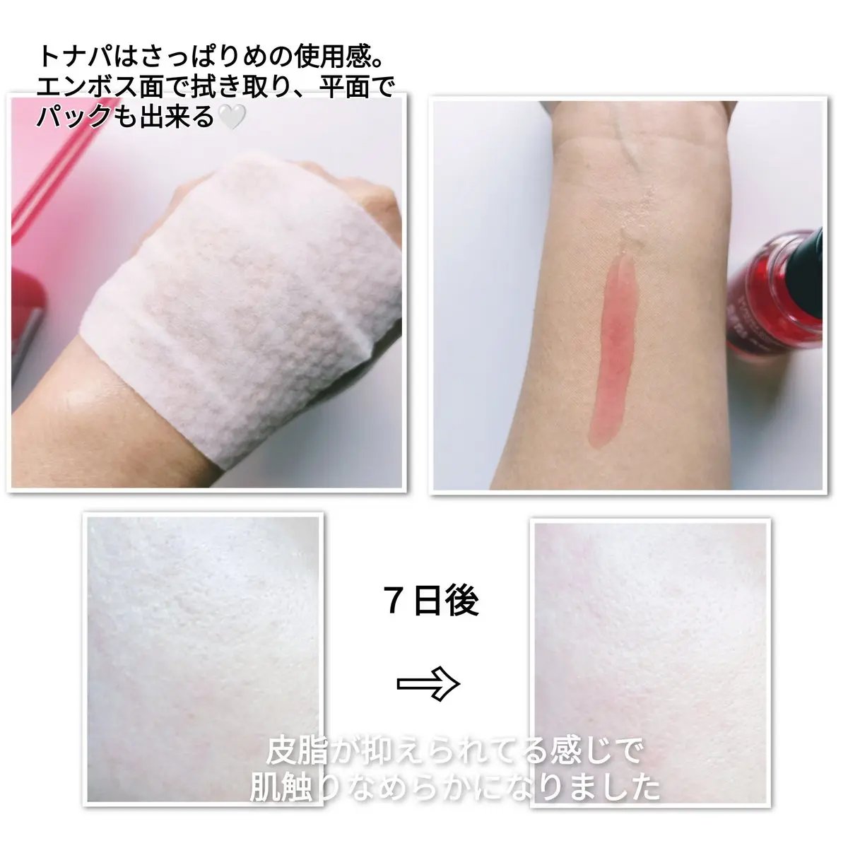 A1カーミング アンプル/VT/美容液を使ったクチコミ（3枚目）