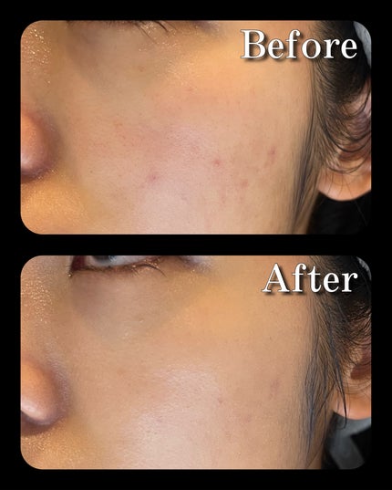 グロウフィットセラムカバークッション/ダルバ/クッションファンデーションを使ったクチコミ(5枚目)