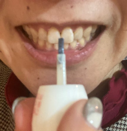 ハニックDC スノー/ハニック・ホワイトラボ/その他オーラルケアを使ったクチコミ(8枚目)