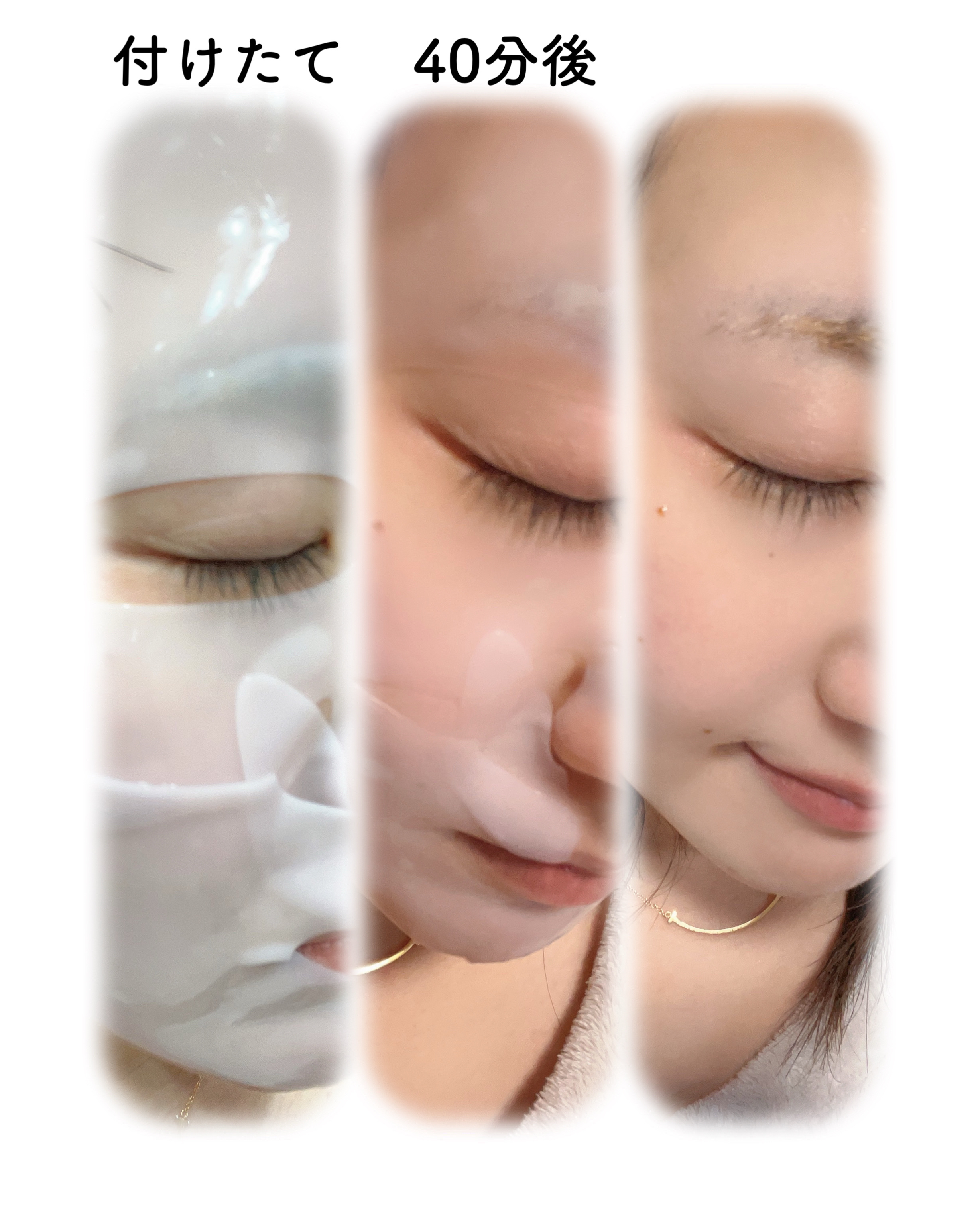 コラーゲンバウンスアップハイパーアクティブゲルマスク/SNP/シートマスク・パックを使ったクチコミ（3枚目）