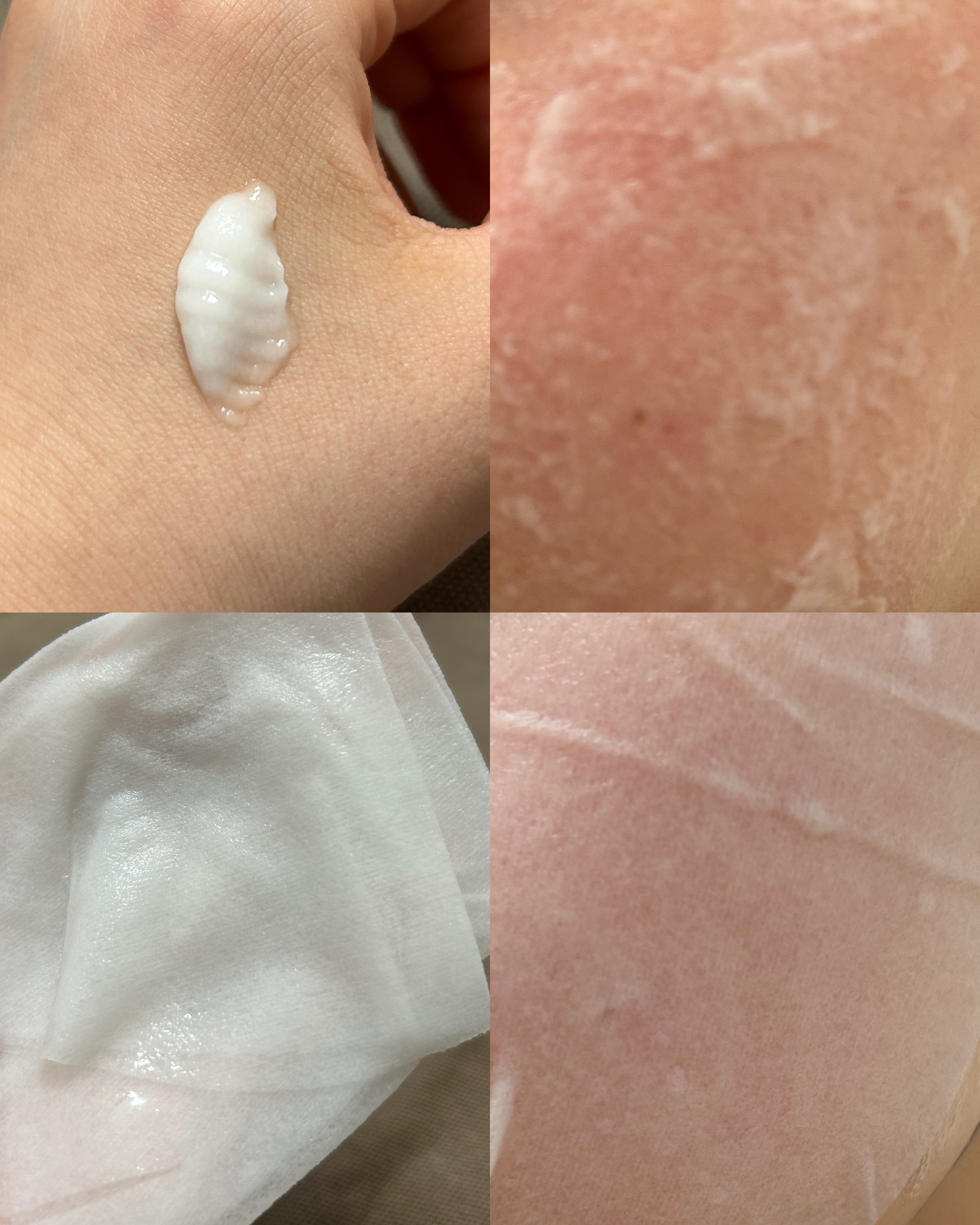 モデリングパックグロウプロジェクト/choRIN/シートマスク・パックを使ったクチコミ（3枚目）