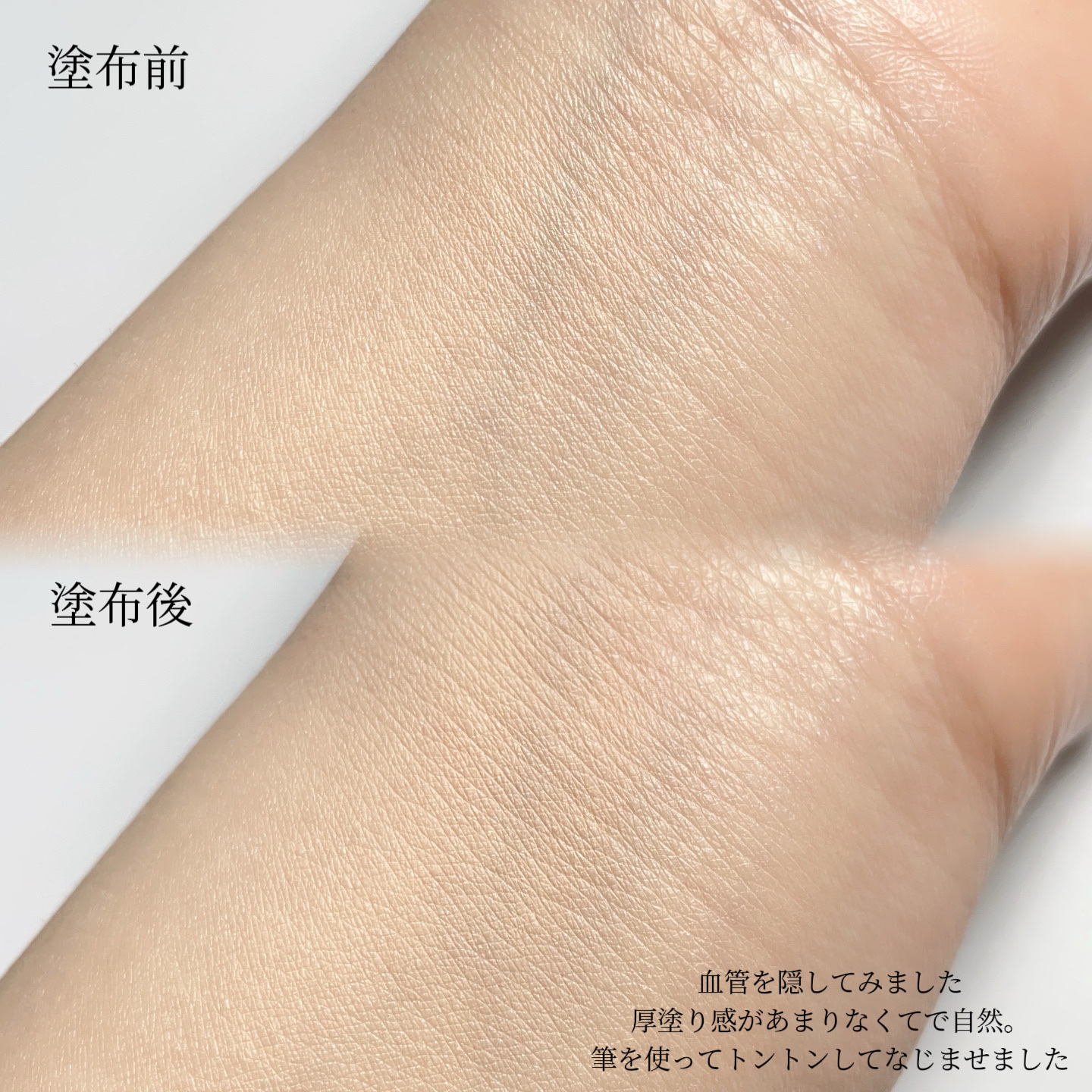 薬用コンシーラー アクネプロテクター/ONLY MINERALS/パウダーコンシーラーを使ったクチコミ（3枚目）