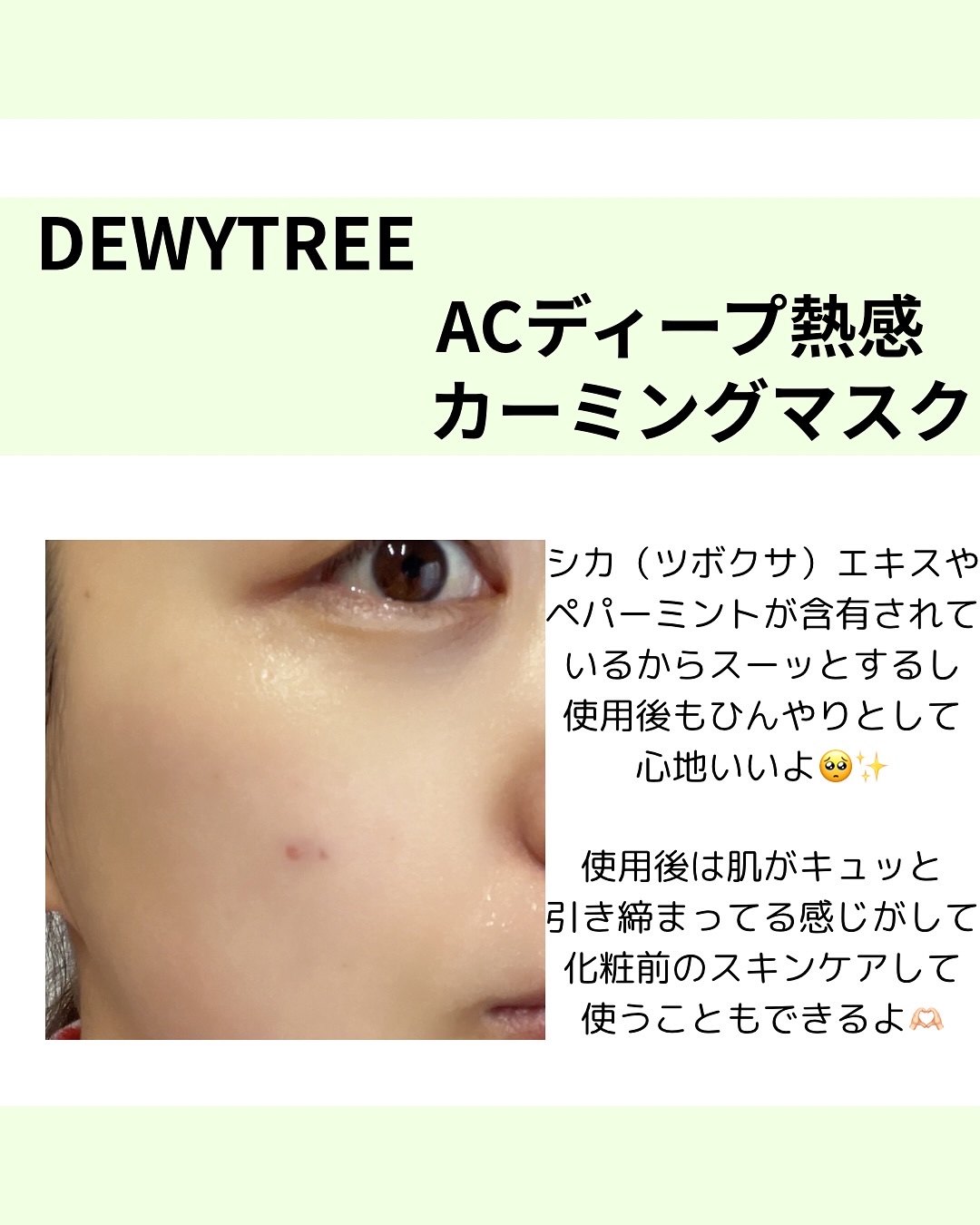 ACディープブレミッシュカーミングマスク/DEWYTREE/シートマスク・パックを使ったクチコミ（3枚目）