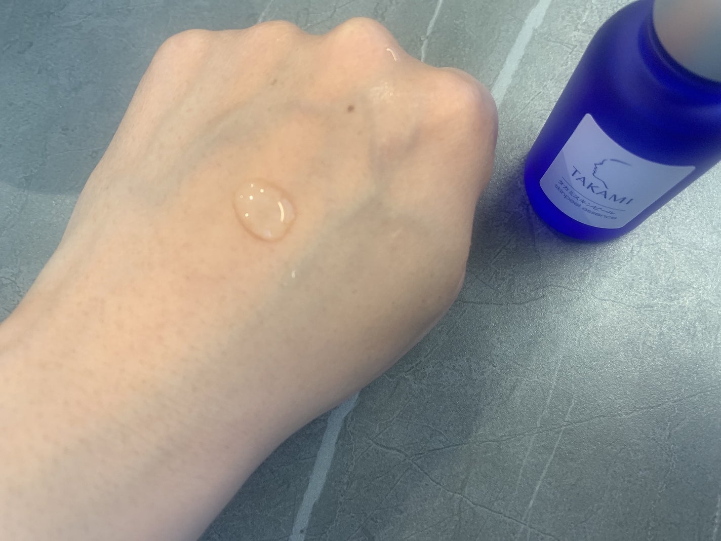 タカミスキンピール/タカミ/ブースター・導入液を使ったクチコミ(2枚目)