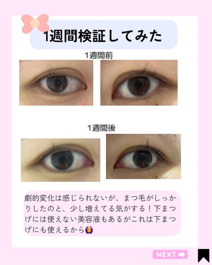 アイラッシュセラム/VIYEUX/まつげ美容液を使ったクチコミ(4枚目)