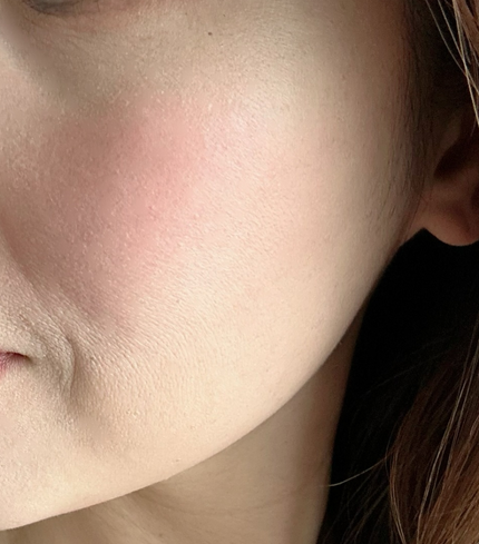 rith♡LIPSパートナー on LIPS 「iminiリペアリキッドチークリキッドチーク&リップにもなるリ..」(4枚目)