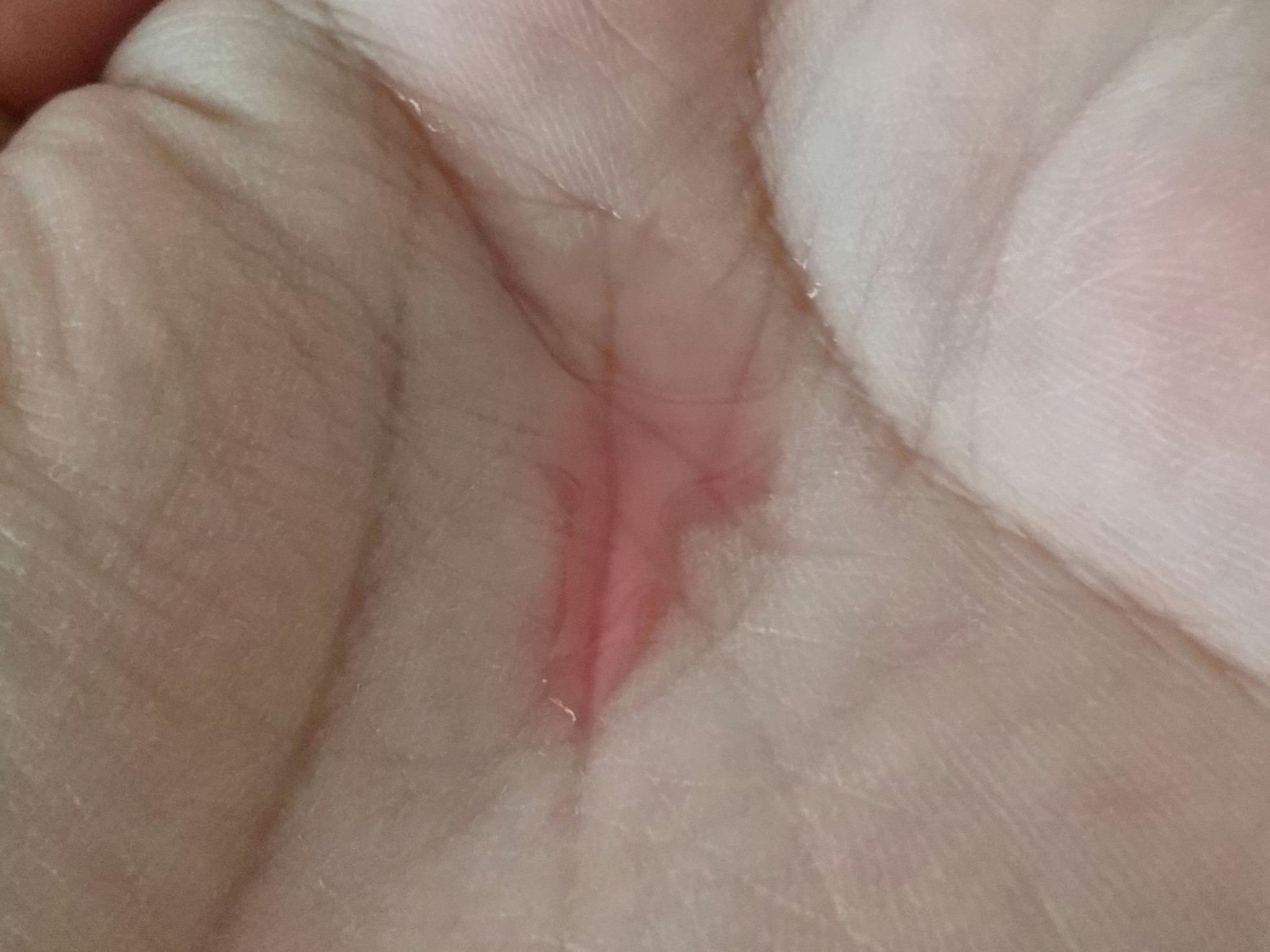 A1カーミング アンプル/VT/美容液を使ったクチコミ（3枚目）