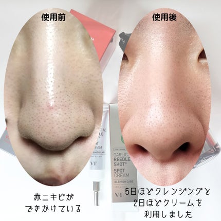 AZケア クレンジングオイル/VT/オイルクレンジングを使ったクチコミ(5枚目)