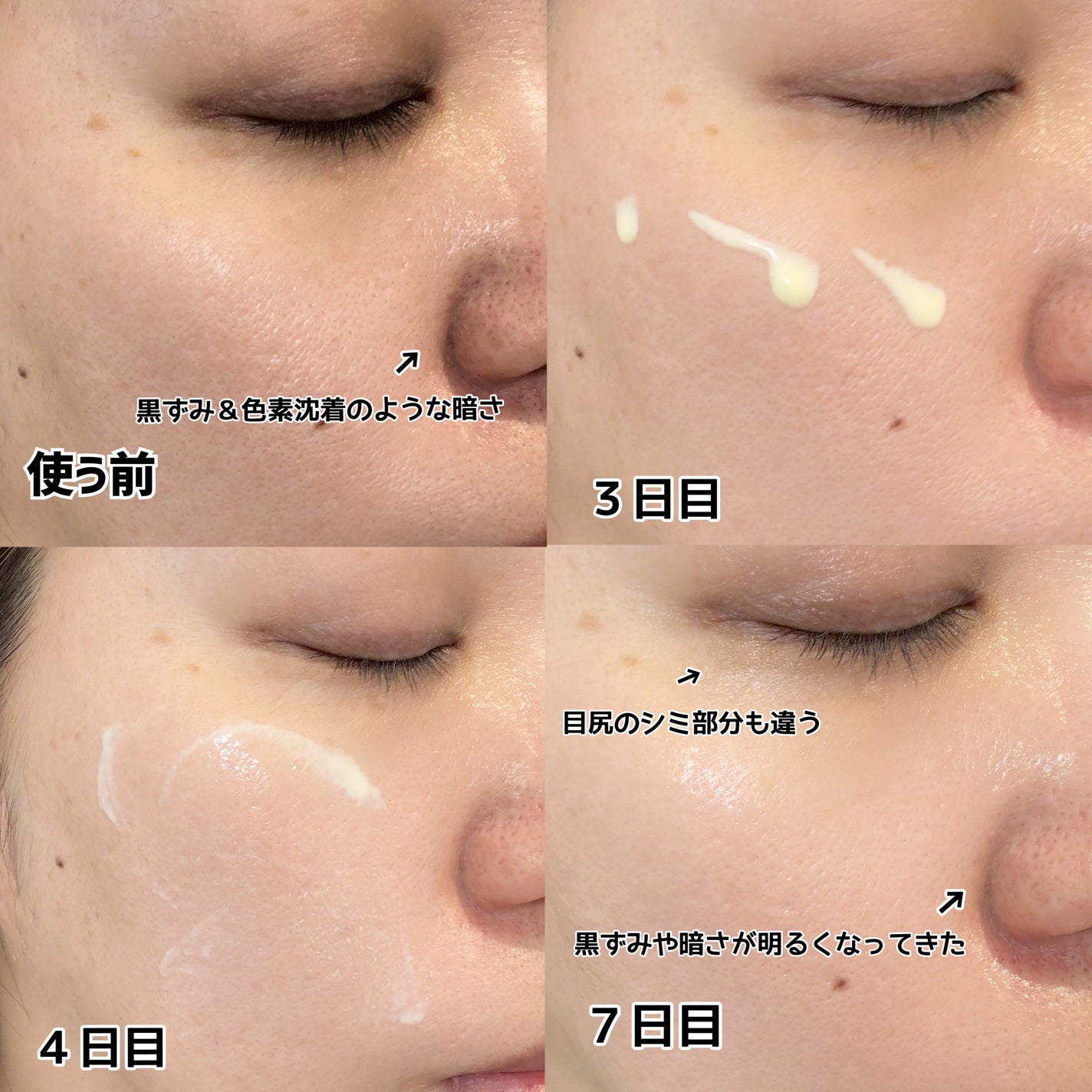 8デイズピュアビタミンCアンプル/VARI:HOPE/美容液を使ったクチコミ(4枚目)