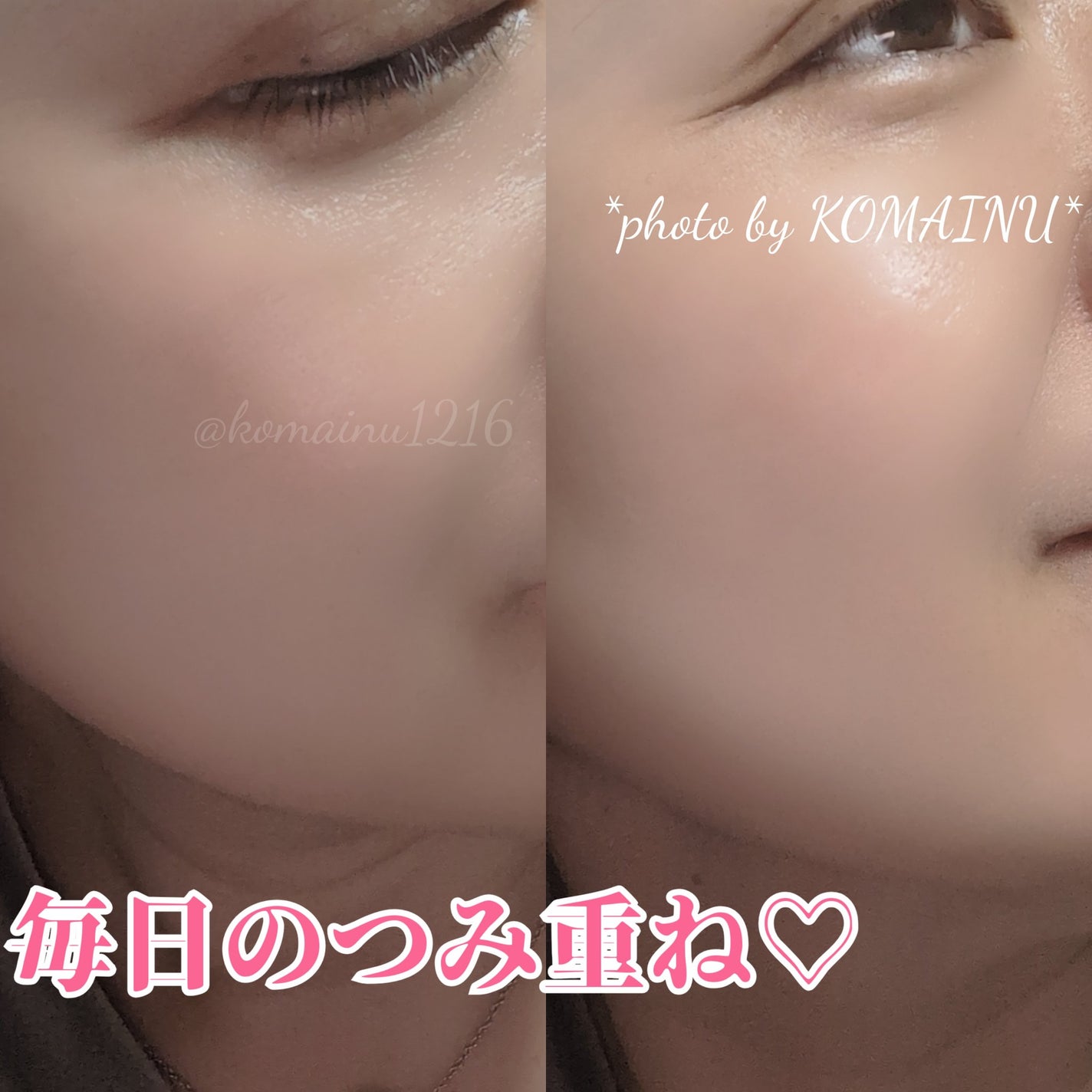 奇蹟のソリューション/YOUTHSECRET/美容液を使ったクチコミ(3枚目)