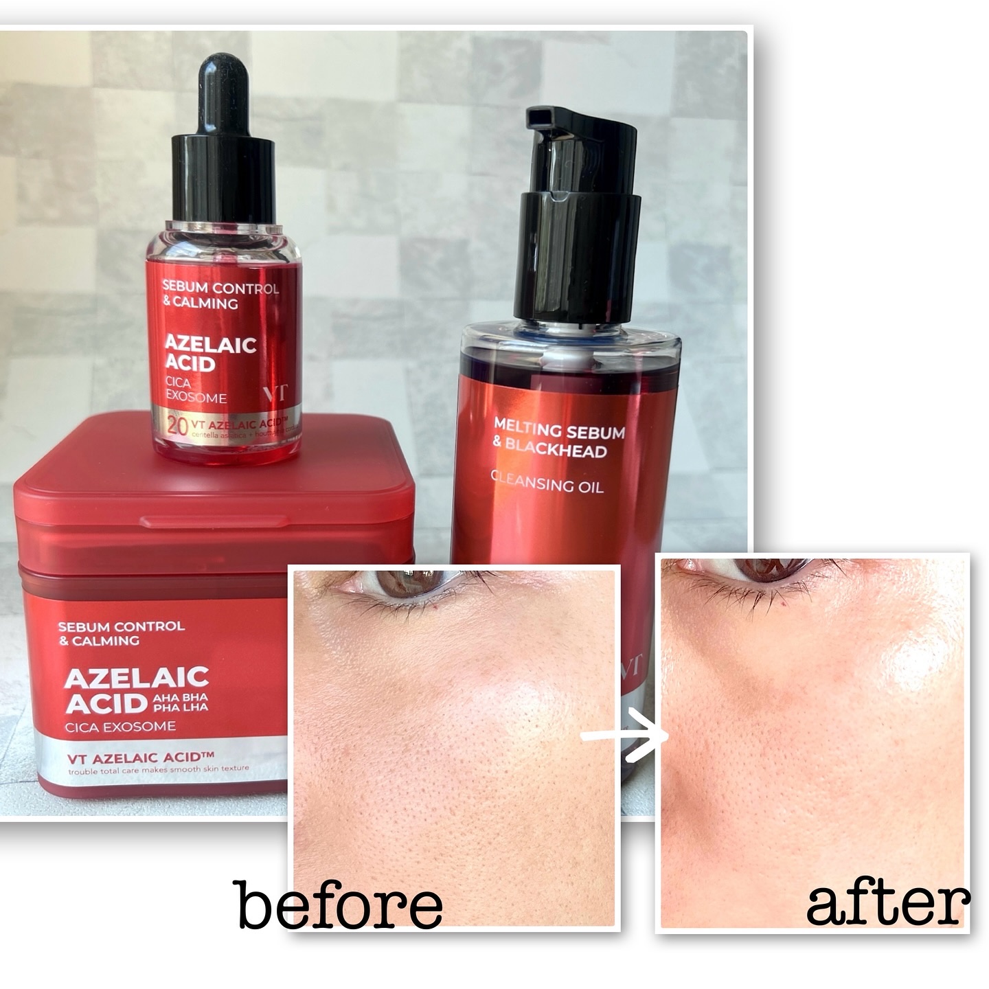 A1カーミング アンプル/VT/美容液を使ったクチコミ（3枚目）