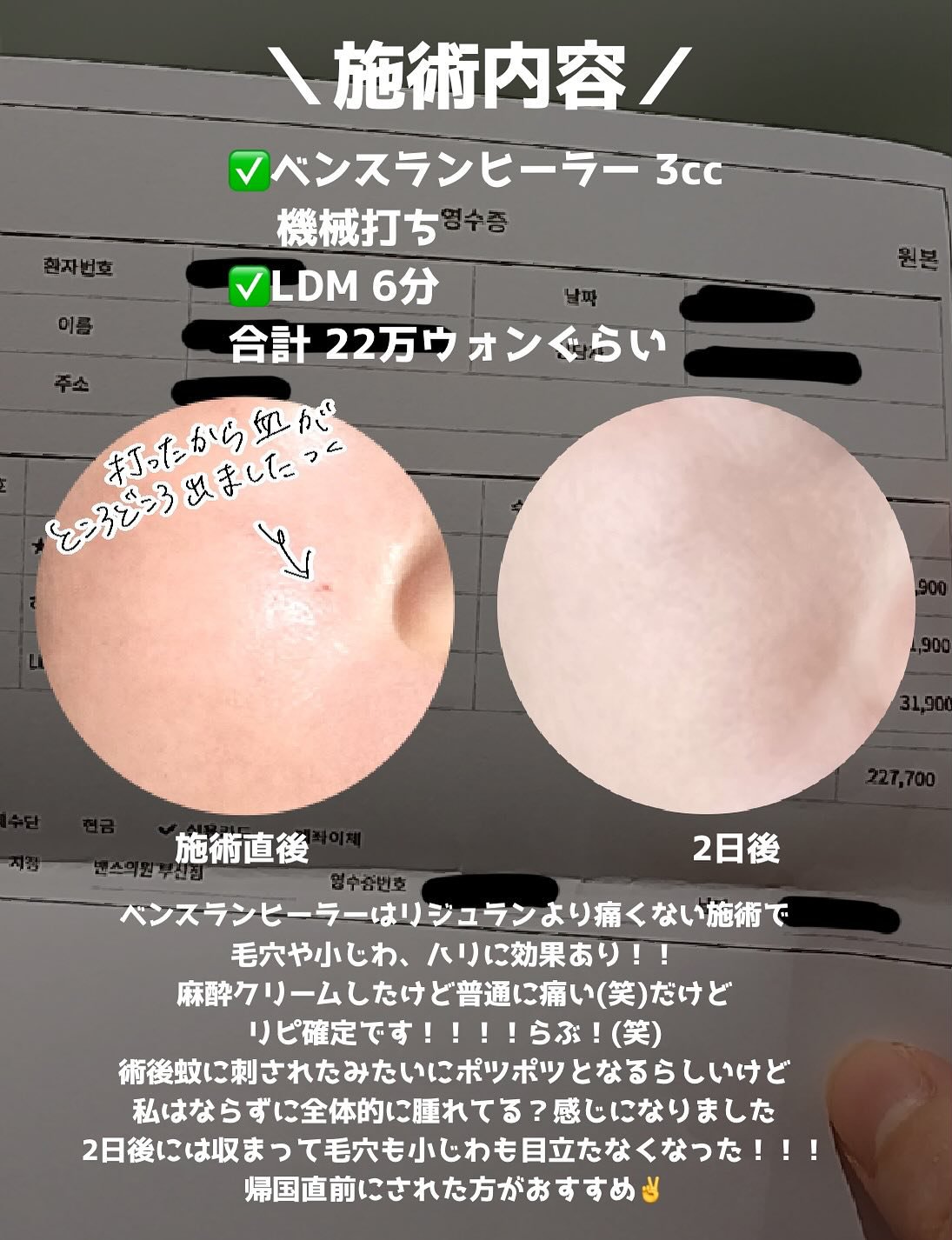 を使ったクチコミ（3枚目）