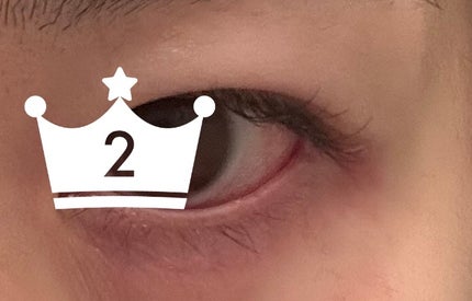 アルマダスタイル EGUTAMのクチコミ「まつ育 4/12
昨日くらいからエグータム使用
下まつ毛がどのくらい伸びるか検証
左の下まつ.....」(2枚目)