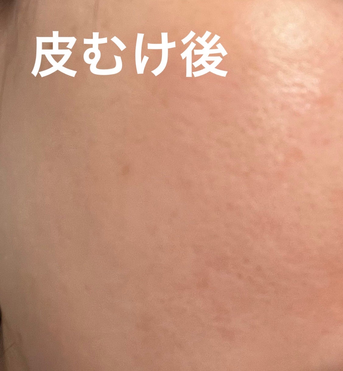 デイリーPD/ZO Skin Health/フェイスクリームを使ったクチコミ(6枚目)