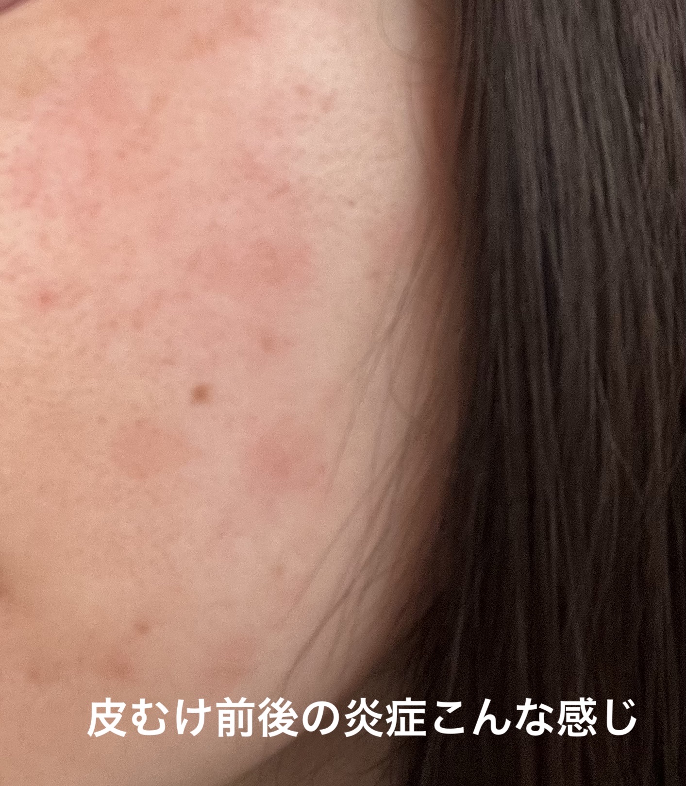 デイリーPD/ZO Skin Health/フェイスクリームを使ったクチコミ（3枚目）