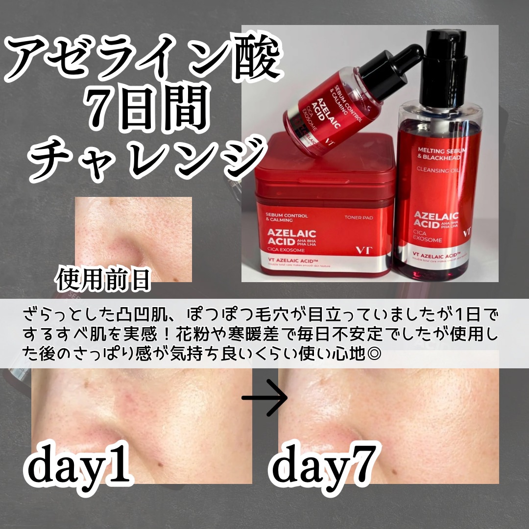 A1カーミング アンプル/VT/美容液を使ったクチコミ（3枚目）