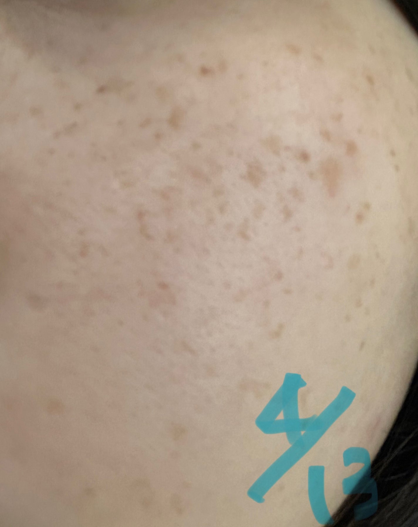 リセットクリアN/BENEFIQUE/化粧水を使ったクチコミ(4枚目)