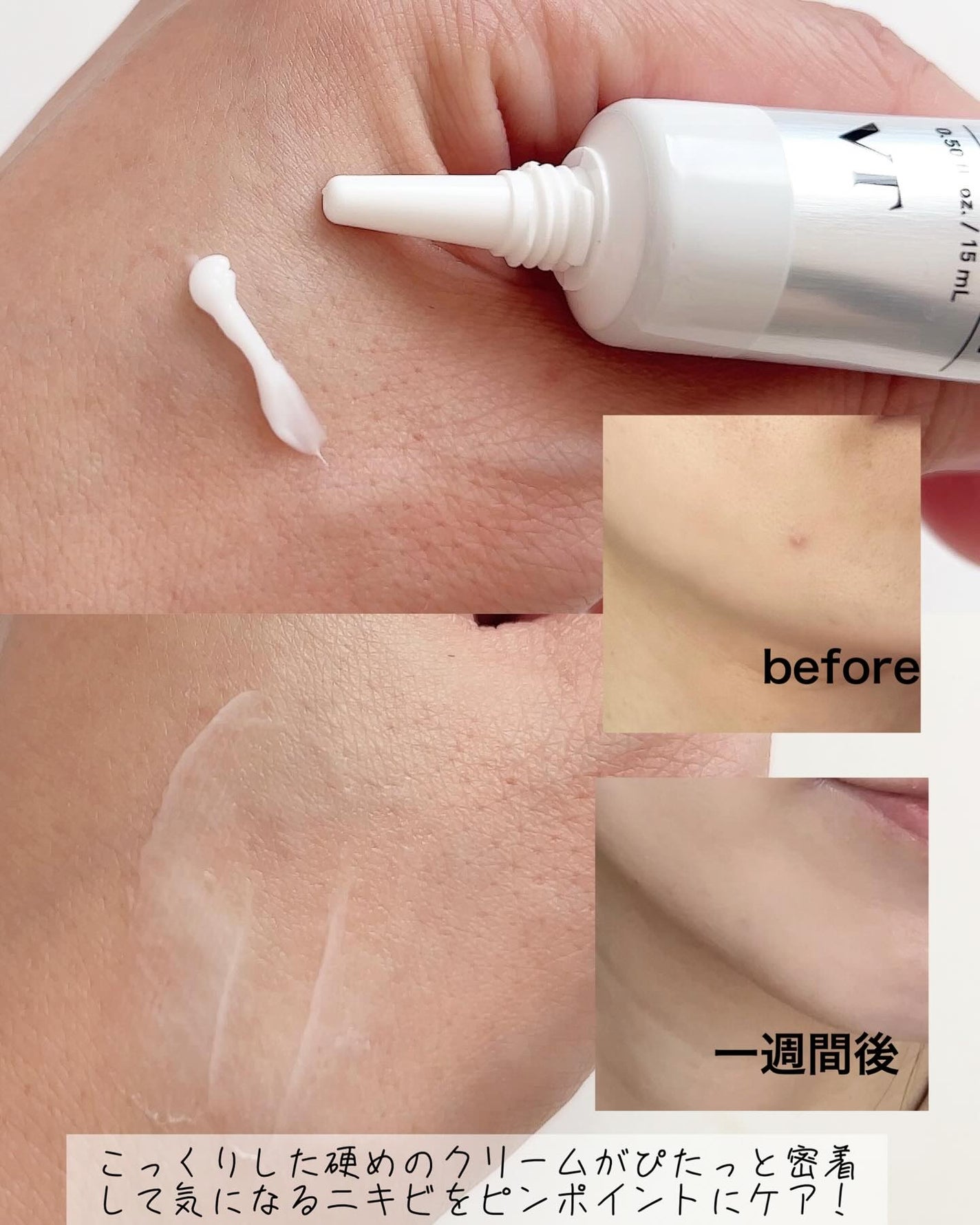 AZケア クレンジングオイル/VT/オイルクレンジングを使ったクチコミ(6枚目)