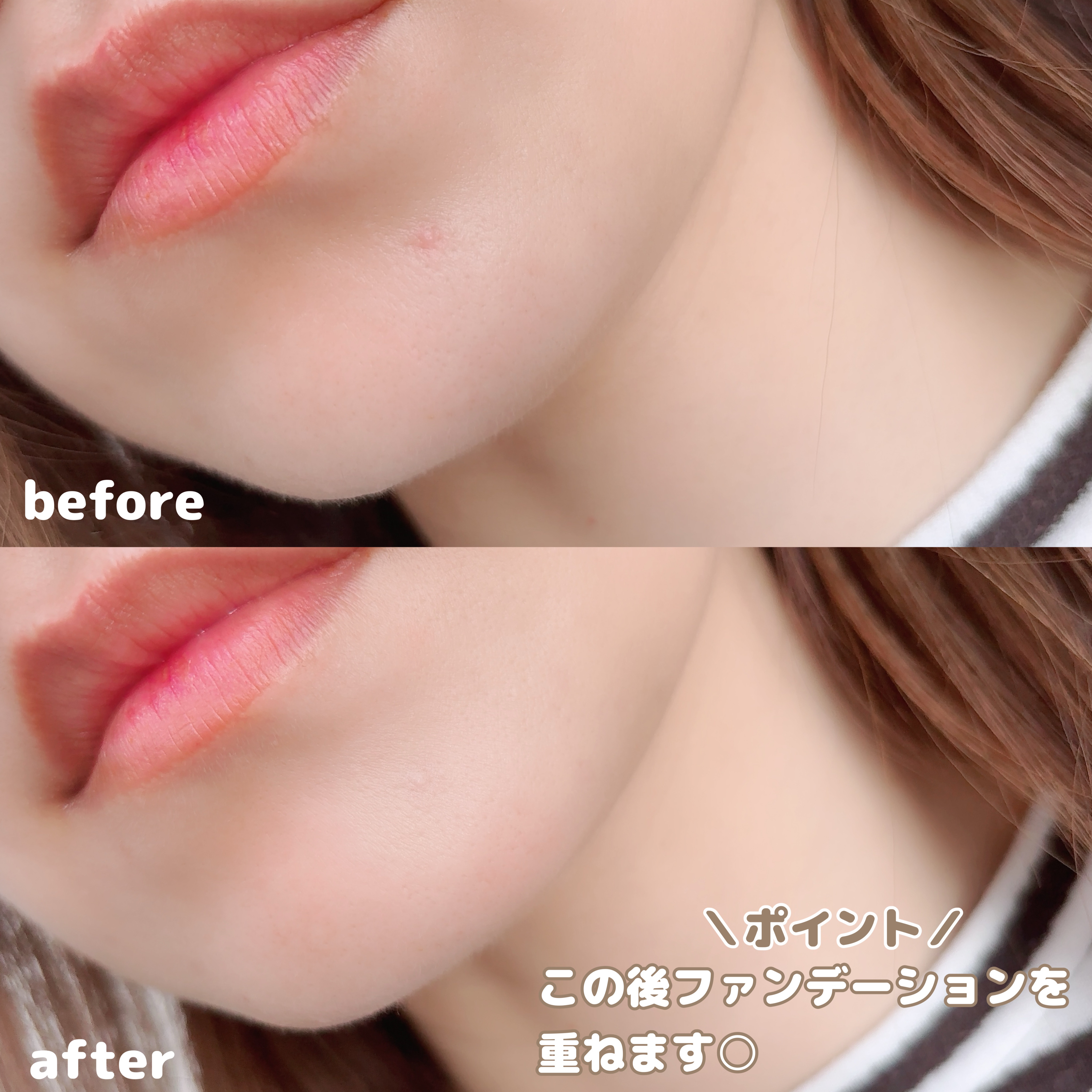 薬用コンシーラー アクネプロテクター/ONLY MINERALS/パウダーコンシーラーを使ったクチコミ（3枚目）