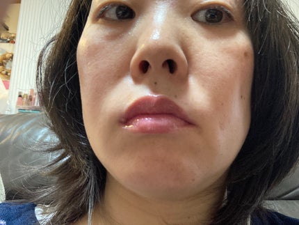 フィー リップアンドチーク グローイジェリーポット/fwee/リップグロスを使ったクチコミ(7枚目)