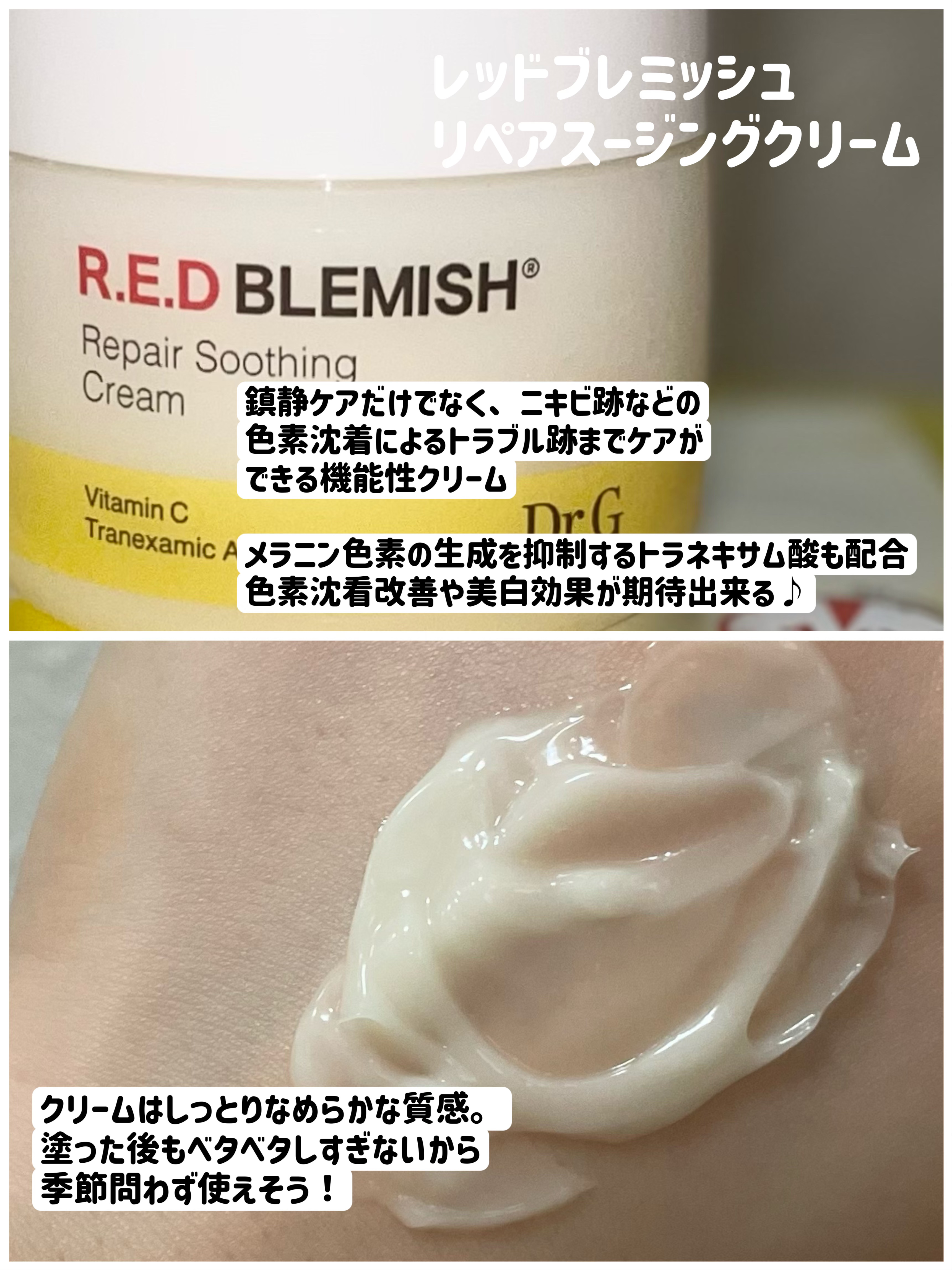 レッドブレミッシュ リペアスージングクリーム/Dr.G/フェイスクリームを使ったクチコミ（3枚目）