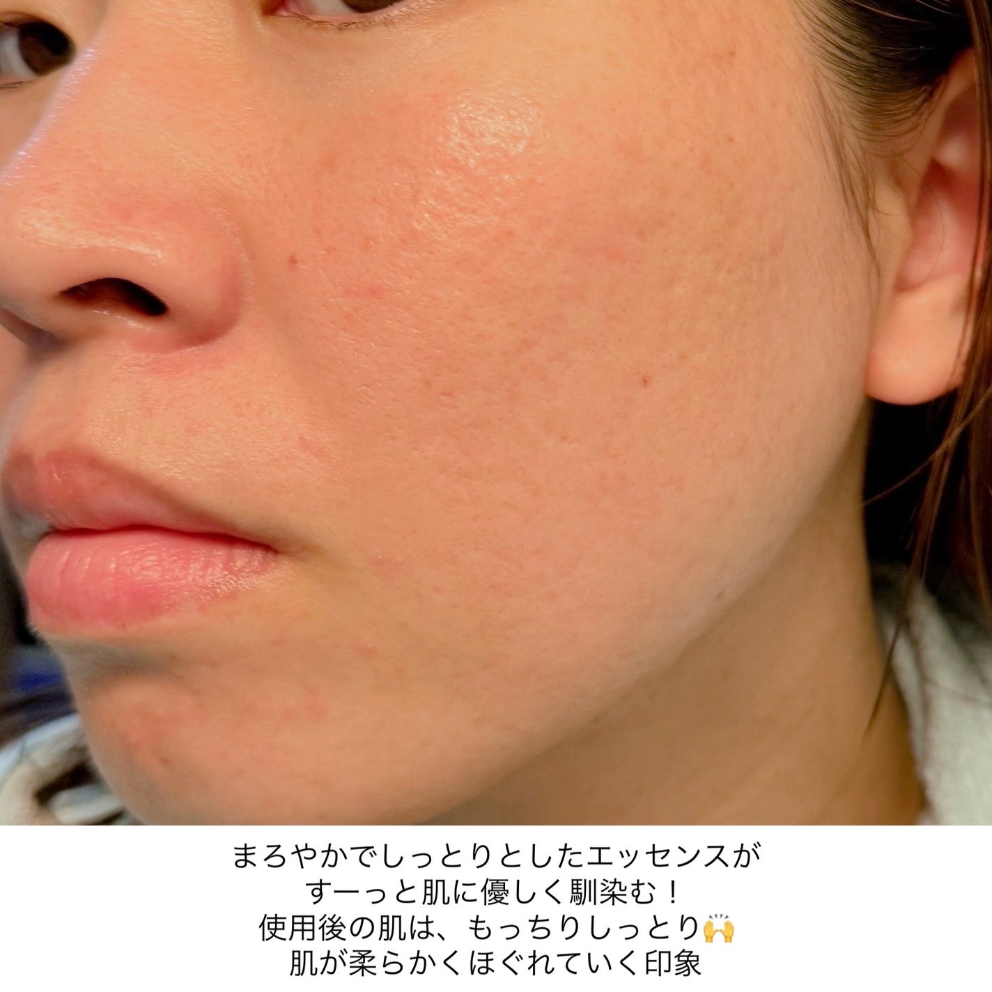 ルルルン トナーパッド うるおいON/ルルルン/トナーパッドを使ったクチコミ(6枚目)