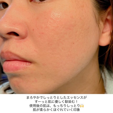 ルルルン トナーパッド うるおいON/ルルルン/トナーパッドを使ったクチコミ(6枚目)