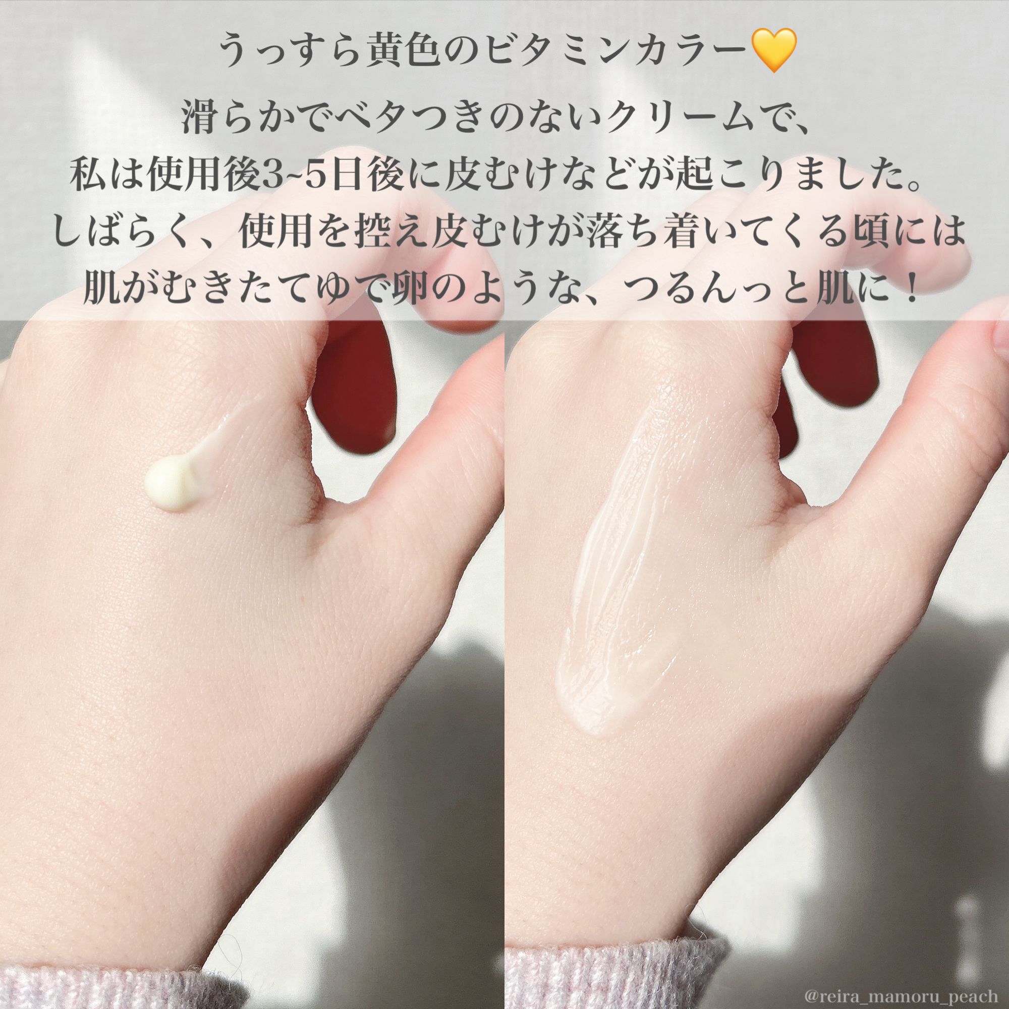 RXザ・レチノール0.3クリーム/COSRX/フェイスクリームを使ったクチコミ（3枚目）