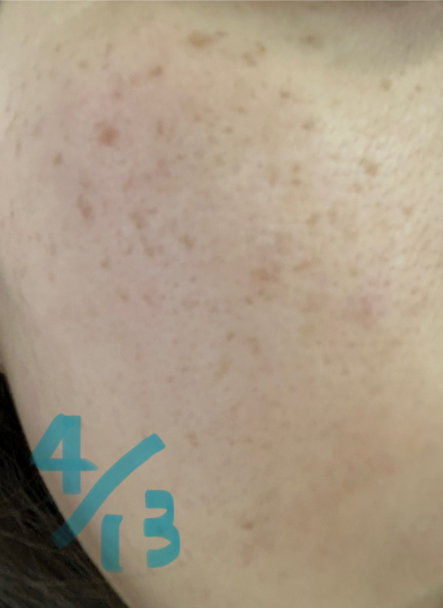 ホリスティックブライト/BENEFIQUE/美容液を使ったクチコミ（2枚目）