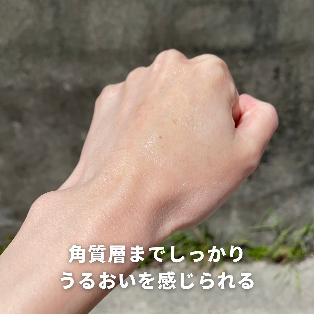 薬用ローション センシティブEX/ドクターシーラボⓇ/化粧水を使ったクチコミ(6枚目)