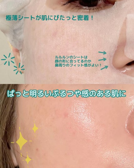 薬用ルルルン 美白アクネ/ルルルン/シートマスク・パックを使ったクチコミ(4枚目)