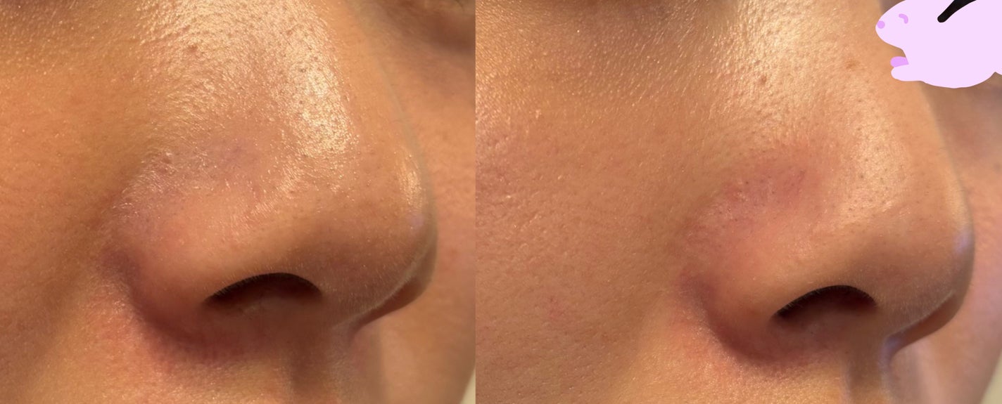 スキンプロテクトベース<皮脂くずれ防止> 超オイリー肌用/プリマヴィスタ/化粧下地を使ったクチコミ(4枚目)