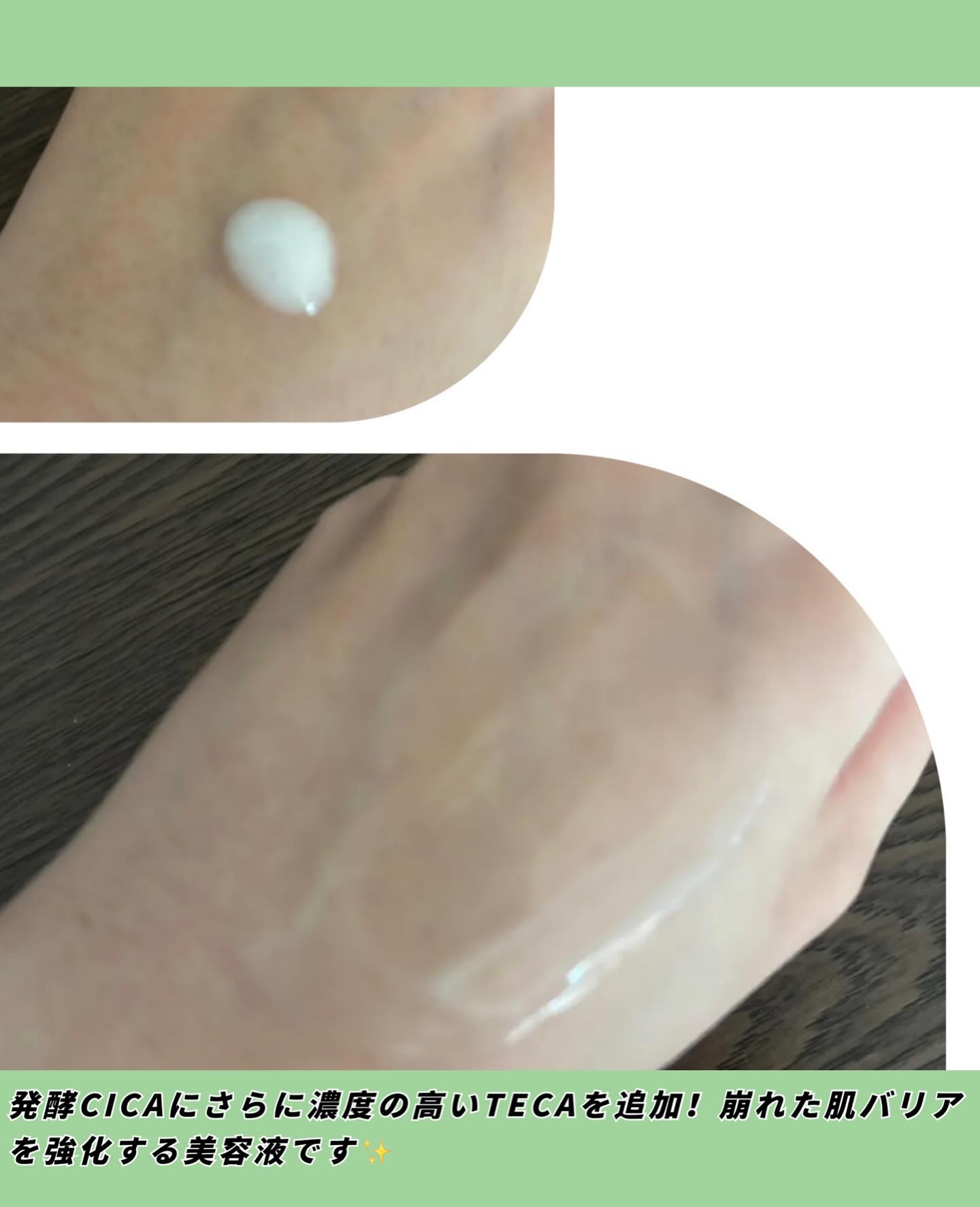 センテラ クイックカーミングパッド/SKIN1004/トナーパッドを使ったクチコミ（3枚目）