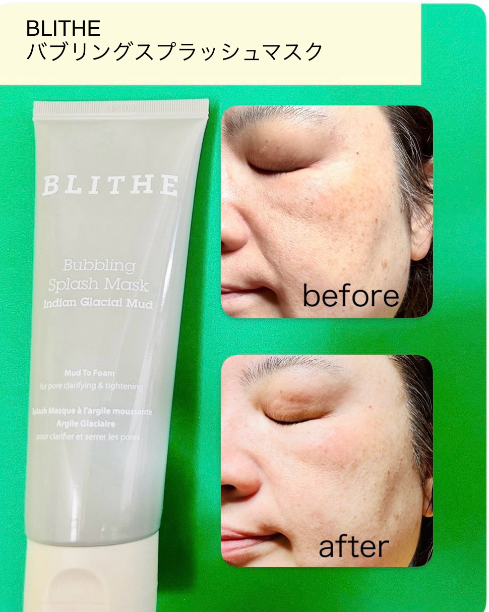 Bubbling Splash Mask Indian Glacial Mud/BLITHE/洗顔フォームを使ったクチコミ（3枚目）