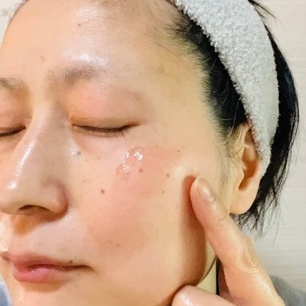 スポットノック WHITE/KIWAMI/美容液を使ったクチコミ(5枚目)